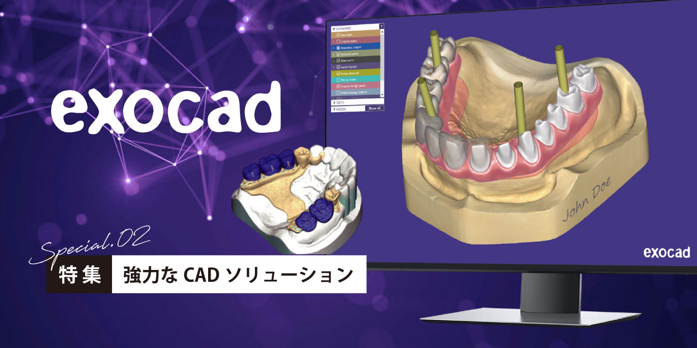 強力なCADソリューション「exocad」