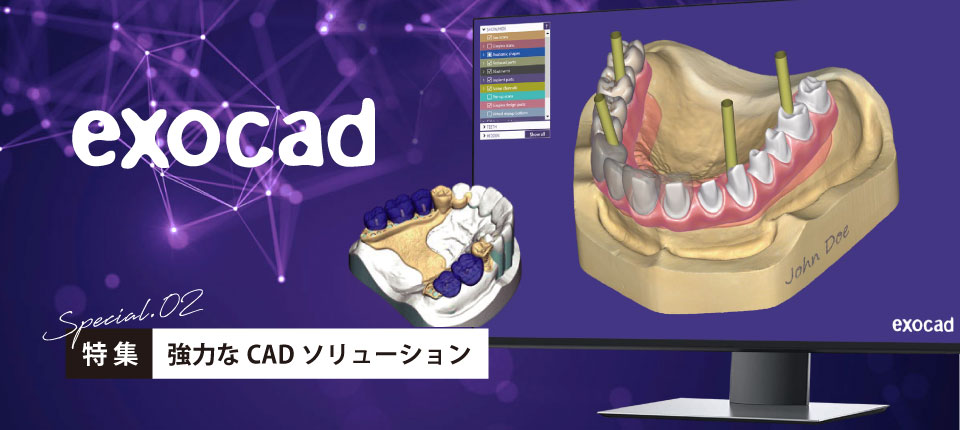 exocad/強力なCADソリューション