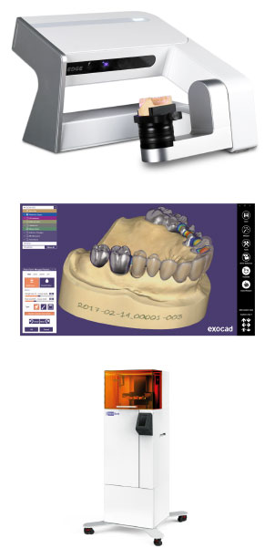 導入事例：EDGE／exocad／NextDent5100