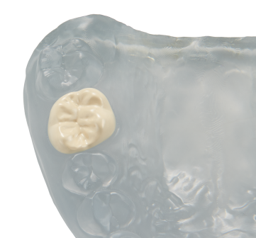 cadcamⅤ PEEK IVORY シール15枚 cadcamⅤ PEEK IVORY シール15枚 cadcamⅤ PEEK IVORY シール15